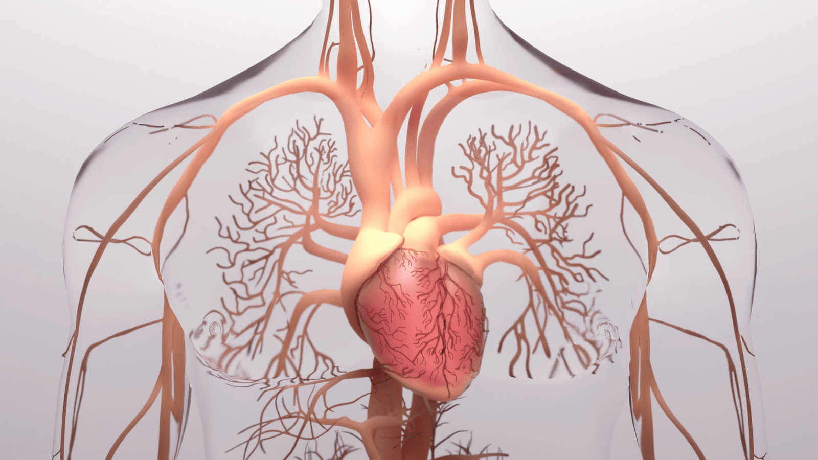 Pulmonary Hypertension